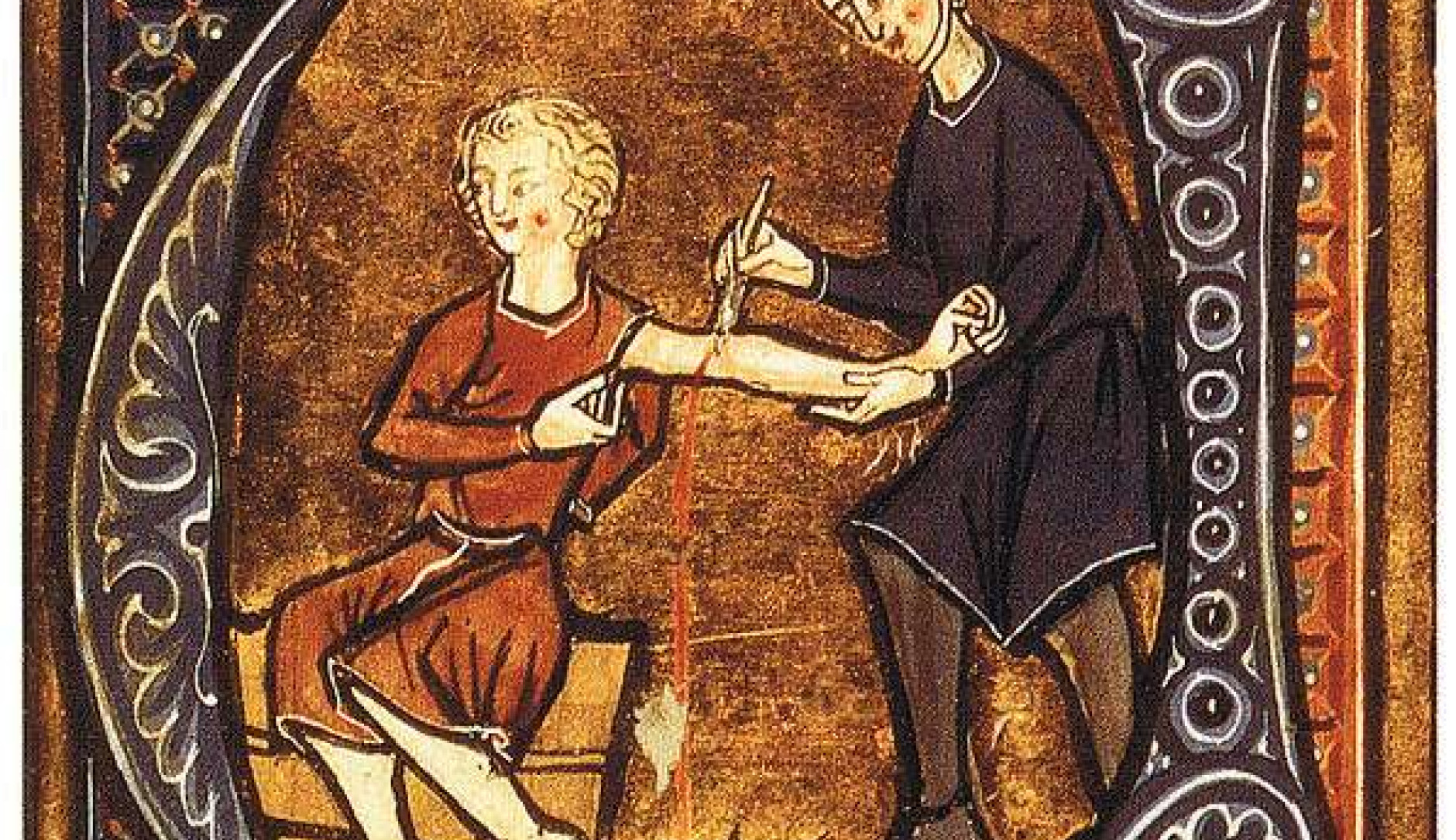 un personnage a droite pratiquant une saignée sur un personnage assis a gauche